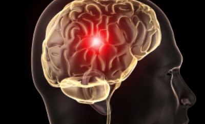 how to improve brain function